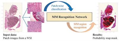 MPMR: Multi-Scale Feature and Probability Map for Melanoma Recognition